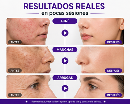 Máscara LED Facial + Cuello 7 Colores